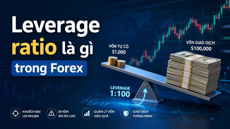 Leverage ratio la gi